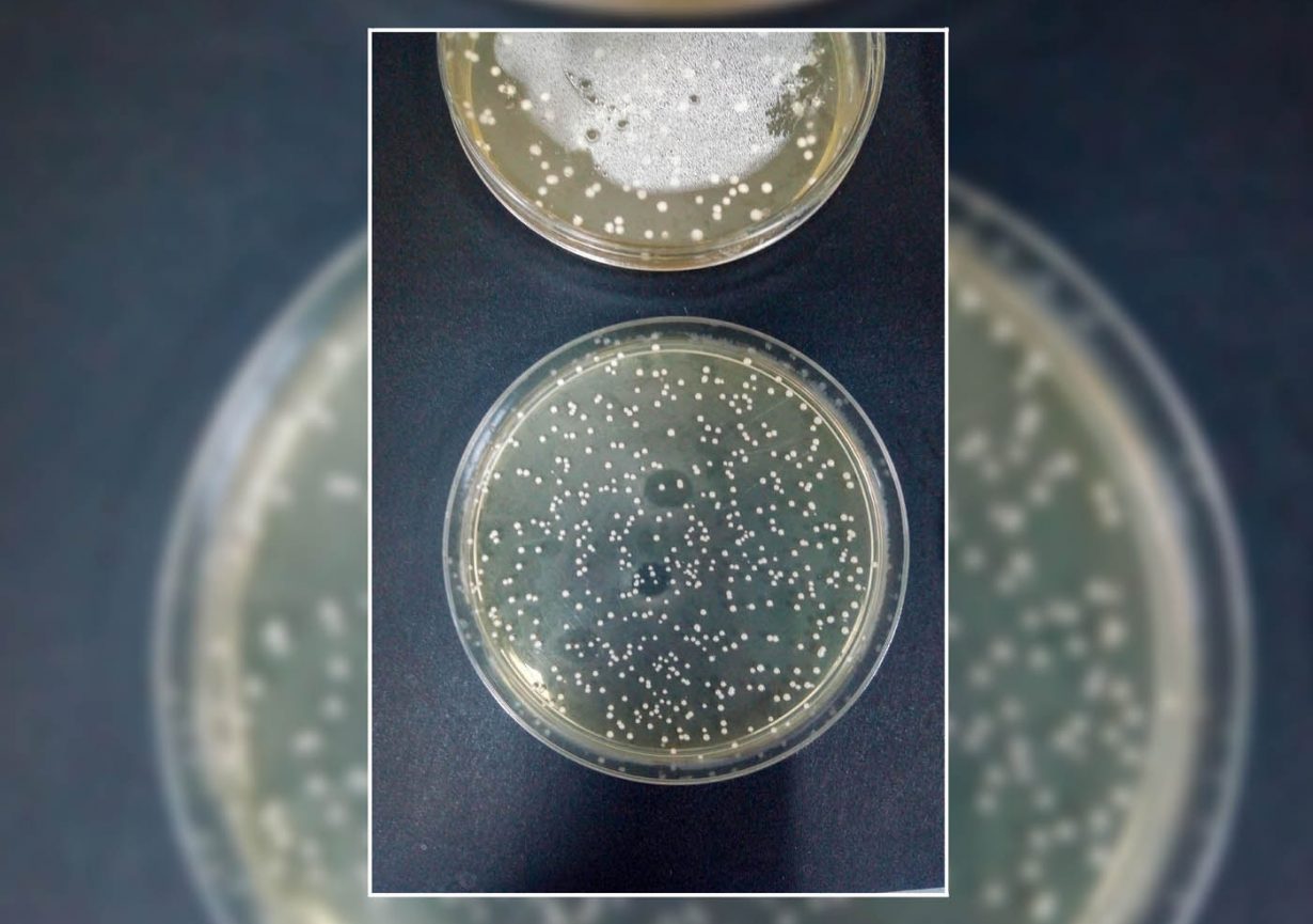 Probióticos en polvo ayudarían en tratamiento de infecciones alimentarias