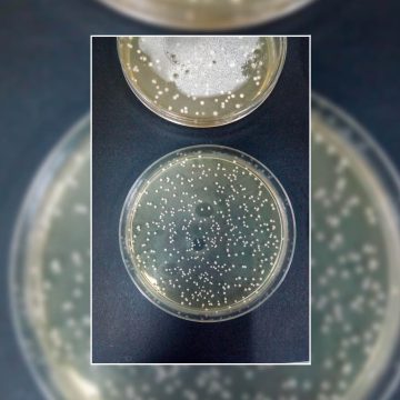 Probióticos en polvo ayudarían en tratamiento de infecciones alimentarias