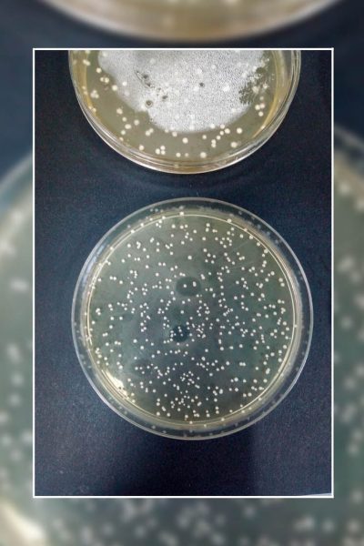 Probióticos en polvo ayudarían en tratamiento de infecciones alimentarias